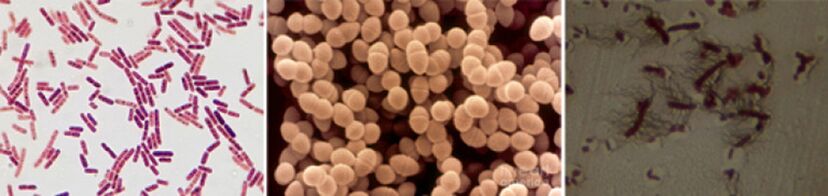 Escherichia lazdelės, išmatų enterokokus ir profesionalūs - pagrindiniai lėtinio bakterinio prostatito patogenai